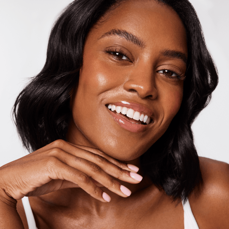 Root Causes of Acne