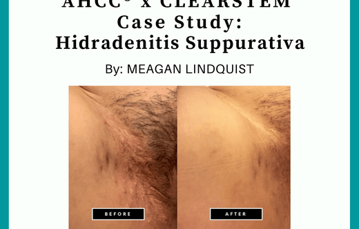 Hidradenitis Suppurativa