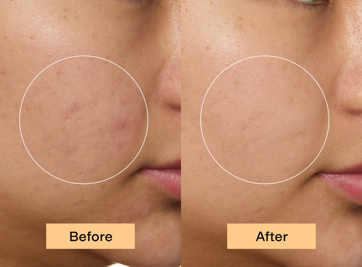 BRIGHTMEUP® before and after face close up