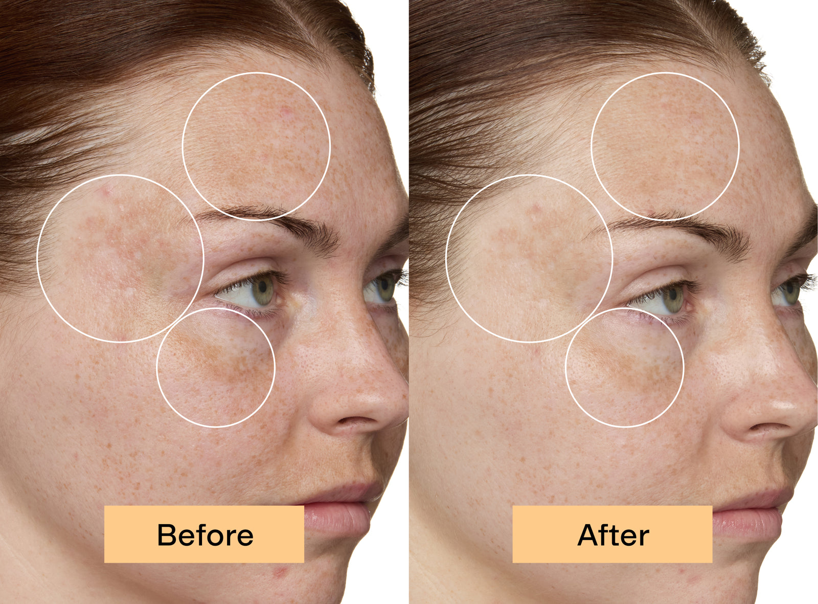 BRIGHTMEUP® before and after face close up